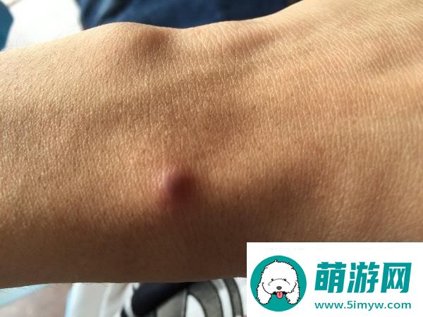 皮下珠子科技界的独树一帜