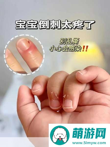 宝宝怎么才三根手指就痛