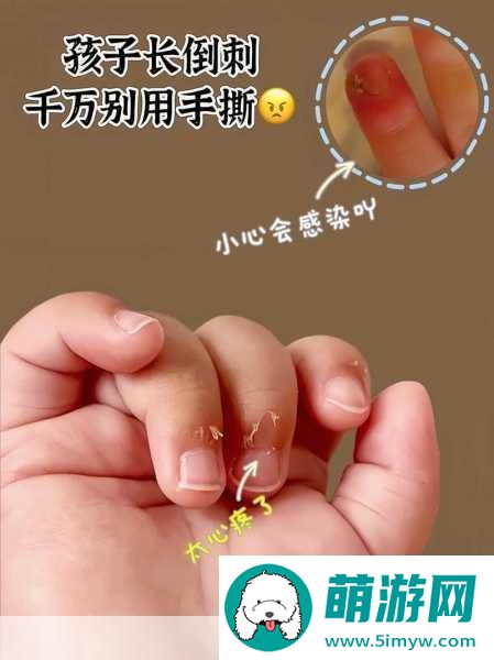 宝宝怎么才三根手指就痛